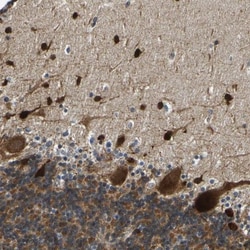 P-Selectin/CD62P Antibody, Novus Biologicals:Antibodies:Primary Antibodies